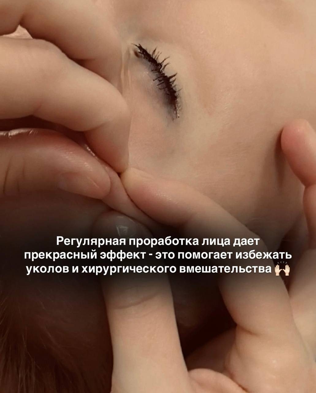 Хотите улучшить кожу лица без уколов?